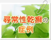 �q�퐫��ᝂ̎��×�